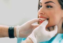 Inside the Mind of a Cosmetic Dentist: What to Expect During a Consultation